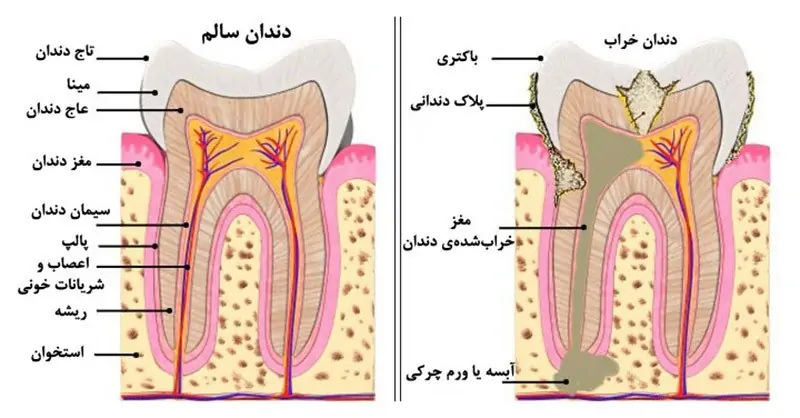 علت‌های دندان درد و انواع دردهای دهان و دندان