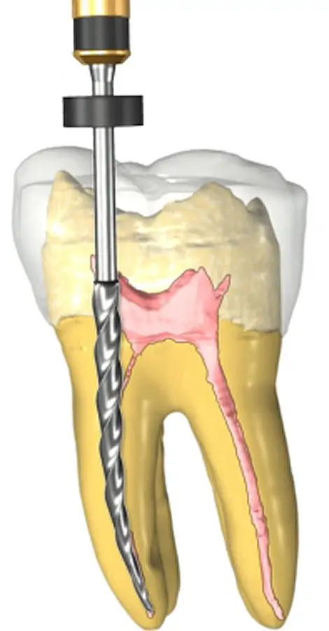 راه‌های درمان دندان درد